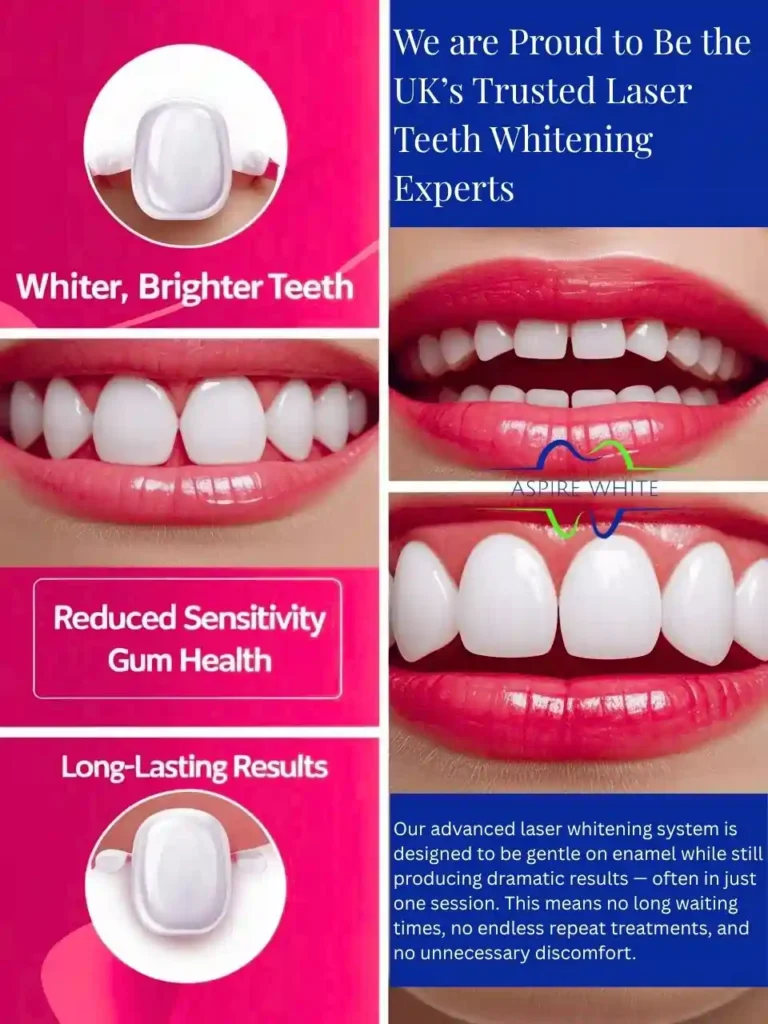 We are Proud to Be the UK’s Trusted Laser Teeth Whitening Experts Reading